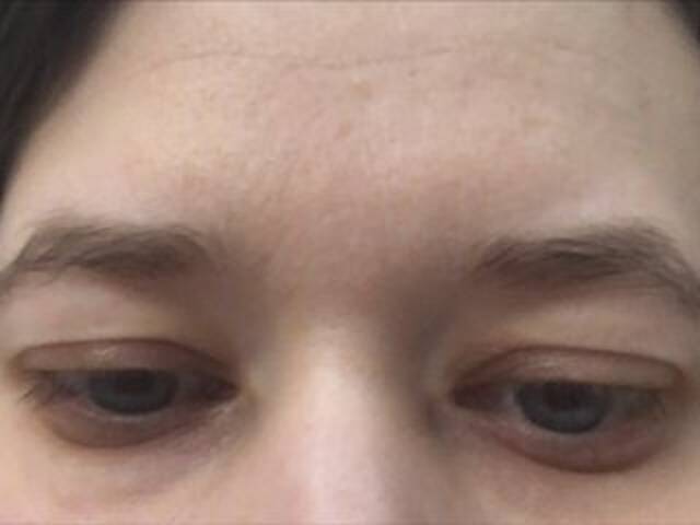 ブロードキャストスクリーンショット Lorena_25