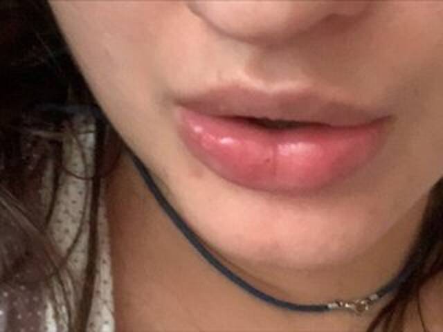 ブロードキャストスクリーンショット Rinaru555555