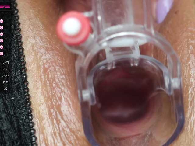 ブロードキャストスクリーンショット StellaFlurry